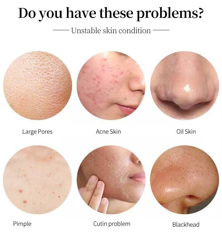 Face Serum with Kojic Acid | Anti-Pigmentation | Reduce Dark Spots | 30 ml – изображение 3 | NetTrade.ee