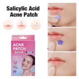 Acne patches hydrocolloid | 20 pcs - NETTRADEHOUSE